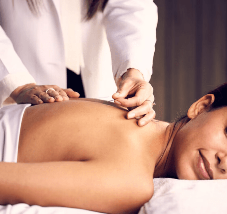 Acupuncture